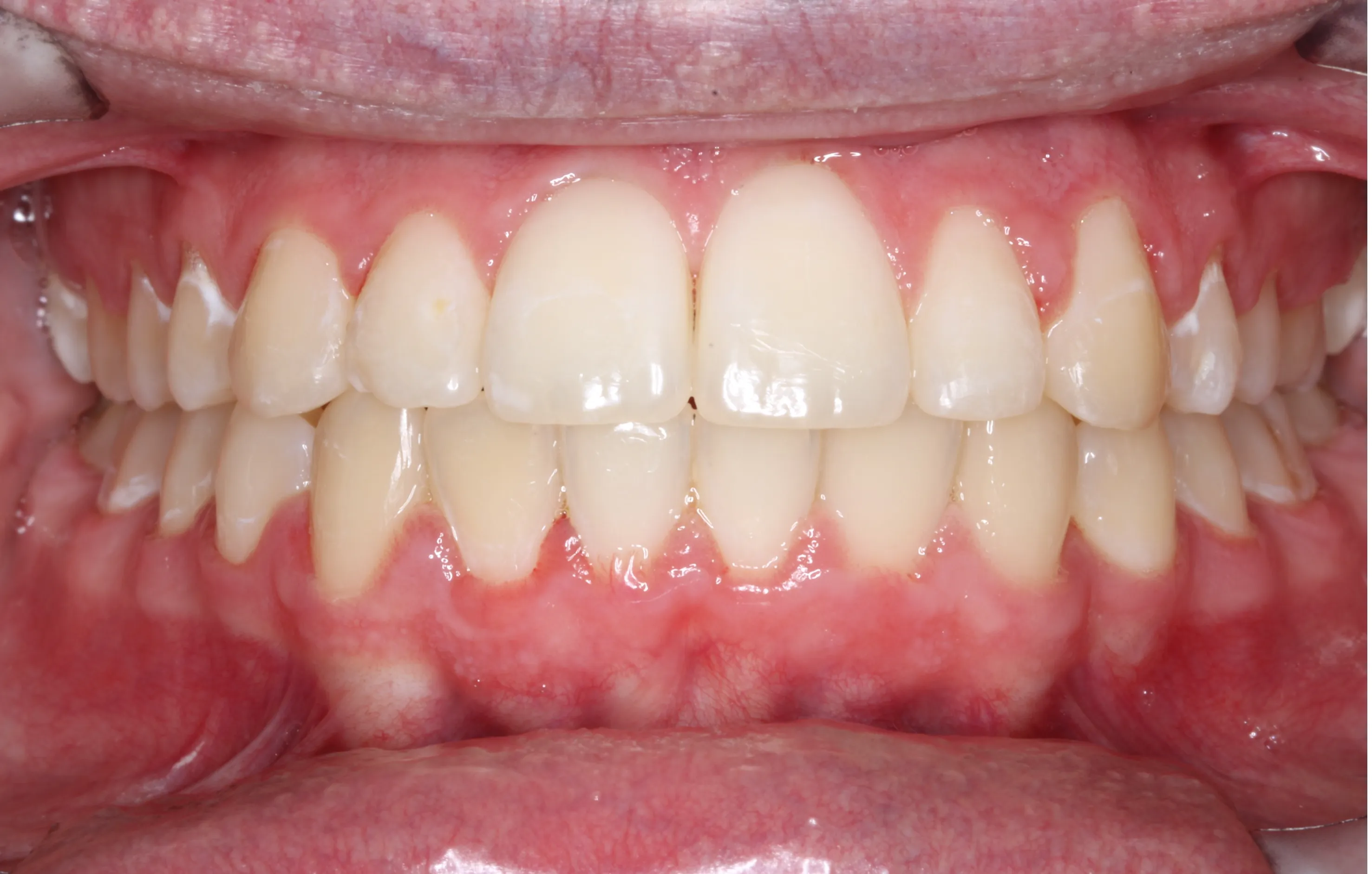 smile-gallery gallery